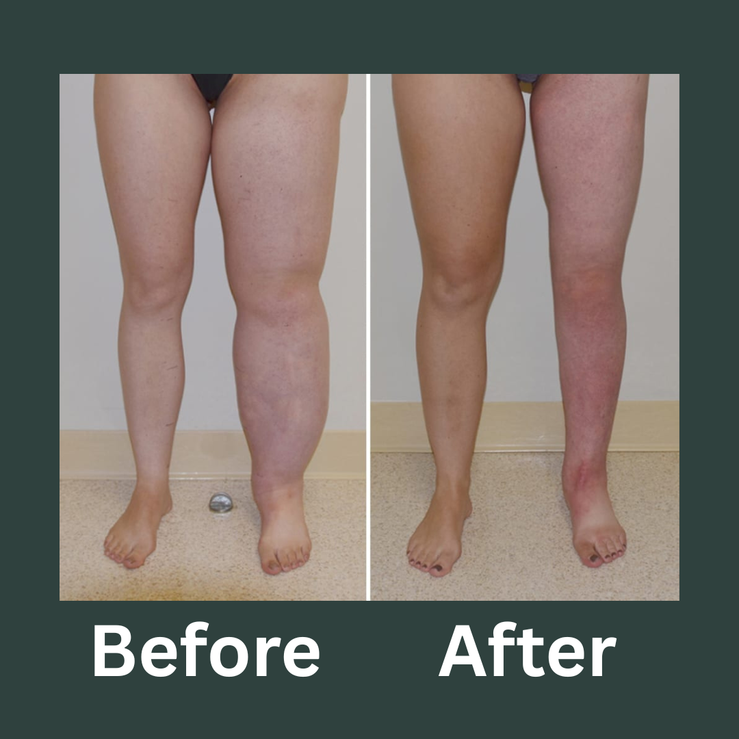 VeinFlow™ Herbal Drop Complex